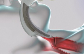 Dahlhausen Video-Laryngoskop "VL3D" für Einmalspatel