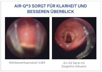 Air-Q®sp3 Einweg-Larynxmaske mit selbstdichtendem Cuff 3