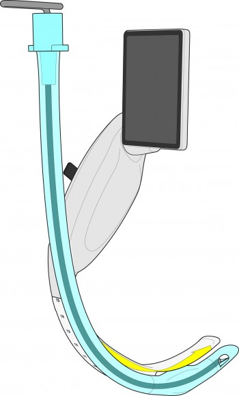 McGRATH® X blade X3