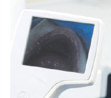 i-view™ Video-Laryngoskop zum Einmalgebrauch