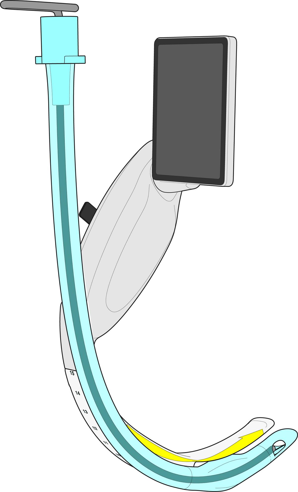 McGRATH® X blade X3X3003000